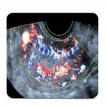 Jaypee Medical Book Obstetrics Gynecology English Edition-0