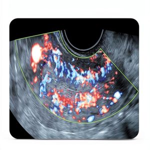 Jaypee Medical Book Obstetrics Gynecology English Edition-0